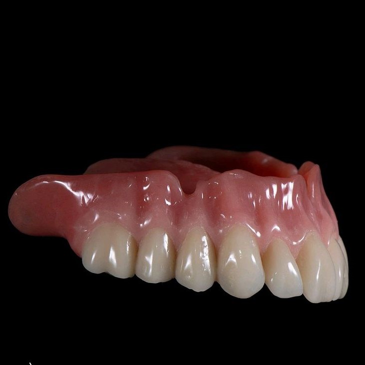 Complete Dentures