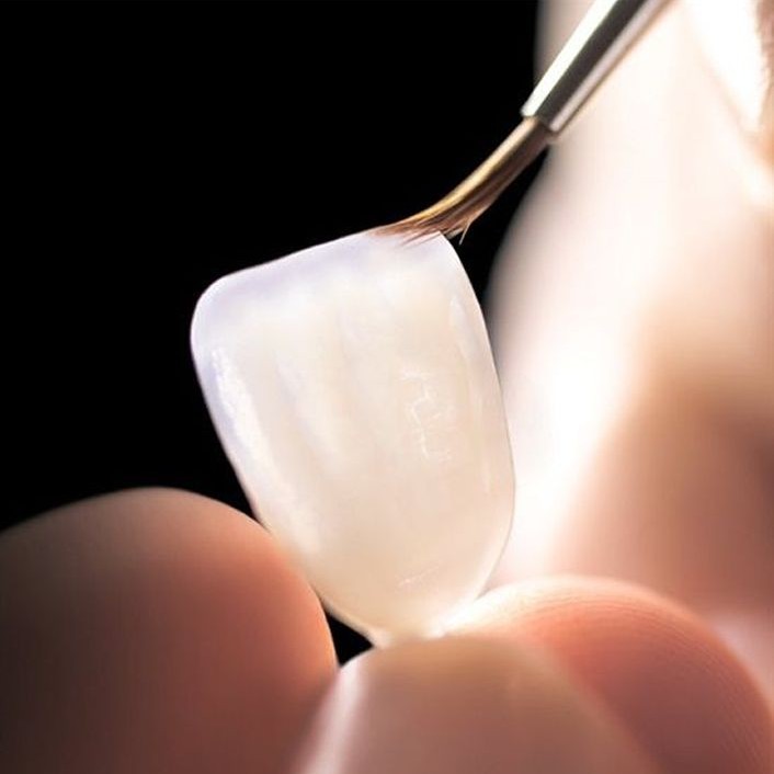 Dental Crowns / Jacket Crowns