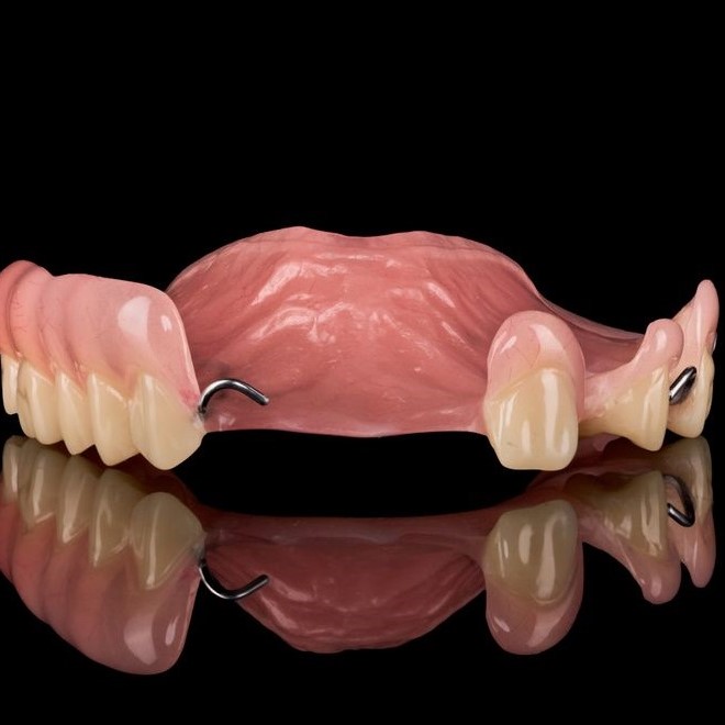 Partial Denture