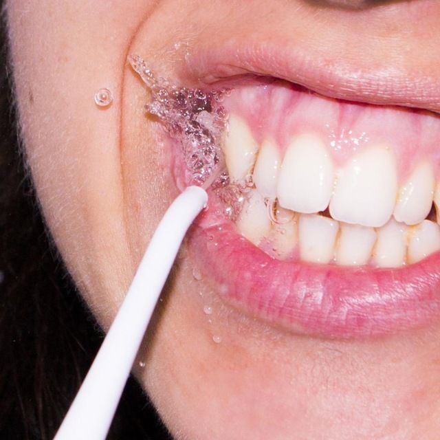 Oral Prophylaxis