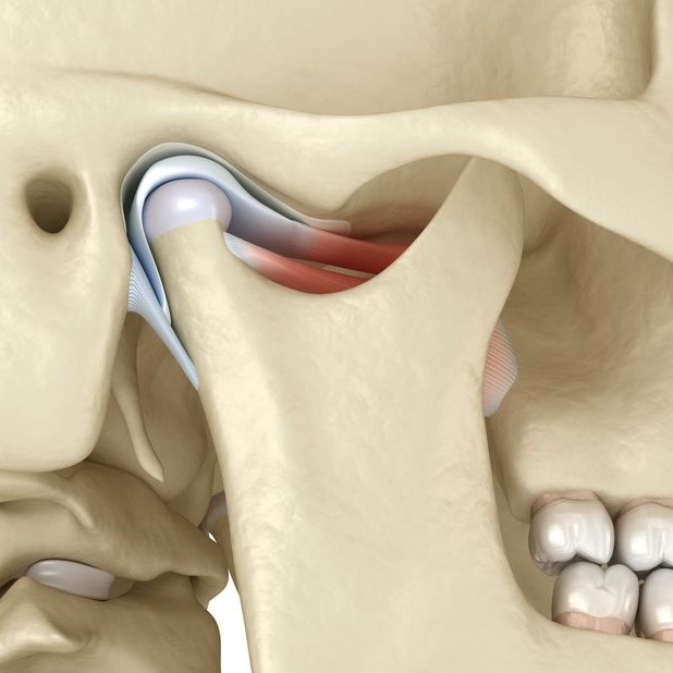 TMJ Disorders
